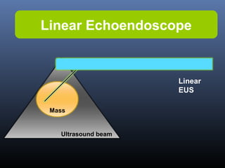 Linear Echoendoscope

Linear
EUS
Mass

Ultrasound beam

 