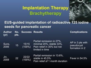 Implantation Therapy
Brachytherapy
EUS-guided implantation of radioactive 125 iodine
seeds for pancreatic cancer
Author
(yr)

Suns,
2006

Jin,
2008

No. Success Results
pts.

Complications

15

15/15
(100%)

Partial remission in 27%,
minimal 20%, stable 33%.
Pain relief in 30% but not
limited in time

AP in 3 pts with
pseudocyst
formation in 2

22

22/22
(100%)

Partial remission in 13.6%,
stable in 45.5%.
Pain relief of 1 month duration

Fever in 54.5%

 