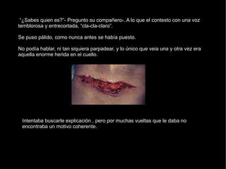 “¿Sabes quien es?”- Pregunto su compañero-. A lo que el contesto con una voz temblorosa y entrecortada, “cla-cla-claro”. Se puso pálido, como nunca antes se había puesto. No podía hablar, ni tan siquiera parpadear, y lo único que veia una y otra vez era aquella enorme herida en el cuello. Intentaba buscarle explicación , pero por muchas vueltas que le daba no encontraba un motivo coherente. 