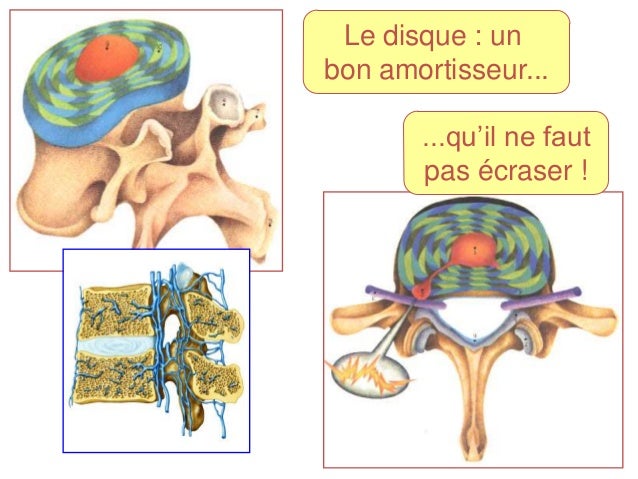 Les conséquences du trauma patrimonial du service cervical chez les nouveau-nées