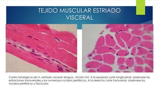 TEJIDO MUSCULAR ESTRIADO
VISCERAL
Cortes histológicos de m. estriado visceral -lengua-, tinción H-E. A la izquierda corte longitudinal, obsérvese las
estriaciones transversales y los numerosos núcleos periféricos. A la derecha corte transversal, obsérvese los
núcleos periféricos y fascículos.
 