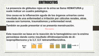 La presencia de glóbulos rojos en la orina se llama HEMATURIA y
suele indicar un cuadro patológico.
Una causa es la inflamación aguda de los órganos urinarios como
resultado de una enfermedad o irritación por cálculos renales, otras
causas son tumores, traumatismos y enfermedad renal.
También se puede presentar si se presenta menstruación.
Esta reacción se basa en la reacción de la hemoglobina con la enzima
peroxidasa dando como resultado dihidroxiperoxido de di-
isopropilbenceno y la 3,3´,5,5´-tetrametilbencidina.
ERITROCITOS
Tira reactiva
 