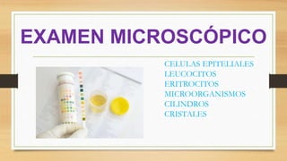 EXAMEN MICROSCÓPICO
CELULAS EPITELIALES
LEUCOCITOS
ERITROCITOS
MICROORGANISMOS
CILINDROS
CRISTALES
 