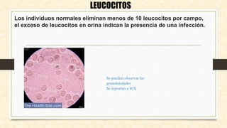 Los individuos normales eliminan menos de 10 leucocitos por campo,
el exceso de leucocitos en orina indican la presencia de una infección.
LEUCOCITOS
Se pueden observar las
granulosidades
Se reportan a 40X
 