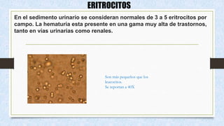 ERITROCITOS
En el sedimento urinario se consideran normales de 3 a 5 eritrocitos por
campo. La hematuria esta presente en una gama muy alta de trastornos,
tanto en vías urinarias como renales.
Son más pequeños que los
leucocitos.
Se reportan a 40X
 