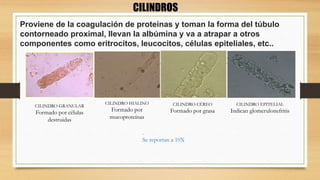 CILINDROS
Proviene de la coagulación de proteínas y toman la forma del túbulo
contorneado proximal, llevan la albúmina y va a atrapar a otros
componentes como eritrocitos, leucocitos, células epiteliales, etc..
CILINDRO GRANULAR
Formado por células
destruidas
CILINDRO HIALINO
Formado por
mucoproteínas
CILINDRO CÉREO
Formado por grasa
CILINDRO EPITELIAL
Indican glomerulonefritis
.
Se reportan a 10X
 