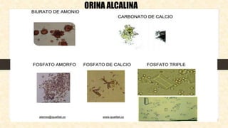 ORINA ALCALINA
 