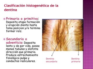  Primaria   o primitiva:
 Deposita etapa formación
 y erupción diente hasta
 toma posicion y/o termina
 formar raíz.

 Secundaria   o
 adventicia: Deposita
 lento y de por vida, posee
 menos tubulos y distinta
 dirección que primaria.
 Produce estrechamiento
 fisiológico pulpa y          Dentina      Dentina
 conductos radiculares.       secundaria   primaria
 