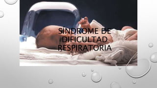 SÍNDROME DE
DIFICULTAD
RESPIRATORIA
 