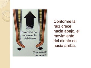Conforme la
raíz crece
hacia abajo, el
movimiento
del diente es
hacia arriba.
 