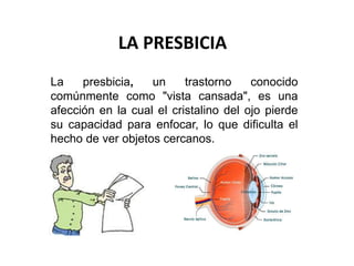 LA PRESBICIA
La presbicia, un trastorno conocido
comúnmente como "vista cansada", es una
afección en la cual el cristalino del ojo pierde
su capacidad para enfocar, lo que dificulta el
hecho de ver objetos cercanos.
 