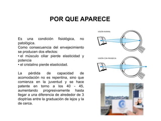POR QUE APARECE
Es una condición fisiológica, no
patológica.
Como consecuencia del envejecimiento
se producen dos efectos:
• el músculo ciliar pierde elasticidad y
potencia
• el cristalino pierde elasticidad.
La pérdida de capacidad de
acomodación no es repentina, sino que
comienza en la juventud y se hace
patente en torno a los 40 - 45,
aumentando progresivamente hasta
llegar a una diferencia de alrededor de 3
dioptrías entre la graduación de lejos y la
de cerca.
 