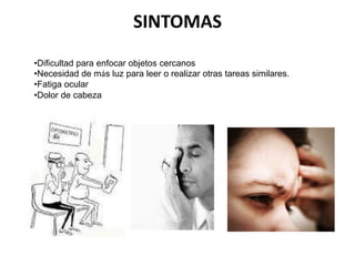SINTOMAS
•Dificultad para enfocar objetos cercanos
•Necesidad de más luz para leer o realizar otras tareas similares.
•Fatiga ocular
•Dolor de cabeza
 