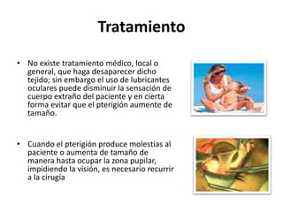 Tratamiento
• No existe tratamiento médico, local o
general, que haga desaparecer dicho
tejido; sin embargo el uso de lubricantes
oculares puede disminuir la sensación de
cuerpo extraño del paciente y en cierta
forma evitar que el pterigión aumente de
tamaño.
• Cuando el pterigión produce molestias al
paciente o aumenta de tamaño de
manera hasta ocupar la zona pupilar,
impidiendo la visión, es necesario recurrir
a la cirugía
 