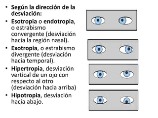 • Según la dirección de la
desviación:
• Esotropia o endotropia,
o estrabismo
convergente (desviación
hacia la región nasal).
• Exotropia, o estrabismo
divergente (desviación
hacia temporal).
• Hipertropia, desviación
vertical de un ojo con
respecto al otro
(desviación hacia arriba)
• Hipotropia, desviación
hacia abajo.
 
