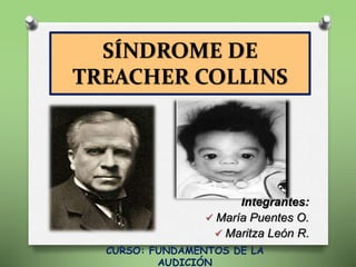 SÍNDROME DE
TREACHER COLLINS
Integrantes:
 María Puentes O.
 Maritza León R.
CURSO: FUNDAMENTOS DE LA
AUDICIÓN
 