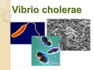 Vibrio cholerae
 