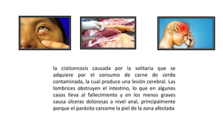 la cisticercosis causada por la solitaria que se
adquiere por el consumo de carne de cerdo
contaminada, la cual produce una lesión cerebral. Las
lombrices obstruyen el intestino, lo que en algunos
casos lleva al fallecimiento y en los menos graves
causa úlceras dolorosas a nivel anal, principalmente
porque el parásito carcome la piel de la zona afectada
 