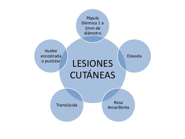 La acupuntura a sheynom la osteocondrosis el foro