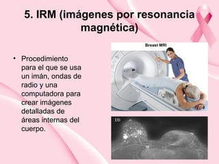 5. IRM (imágenes por resonancia
magnética)
• Procedimiento
para el que se usa
un imán, ondas de
radio y una
computadora para
crear imágenes
detalladas de
áreas internas del
cuerpo.
 