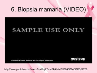 6. Biopsia mamaria (VIDEO)
http://www.youtube.com/watch?v=UlsjZ2zocPk&list=PLD24BB94BDCD572F8
 