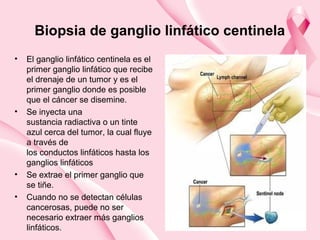 Biopsia de ganglio linfático centinela
• El ganglio linfático centinela es el
primer ganglio linfático que recibe
el drenaje de un tumor y es el
primer ganglio donde es posible
que el cáncer se disemine.
• Se inyecta una
sustancia radiactiva o un tinte
azul cerca del tumor, la cual fluye
a través de
los conductos linfáticos hasta los
ganglios linfáticos
• Se extrae el primer ganglio que
se tiñe.
• Cuando no se detectan células
cancerosas, puede no ser
necesario extraer más ganglios
linfáticos.
 
