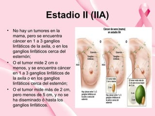 Estadio II (IIA)
• No hay un tumores en la
mama, pero se encuentra
cáncer en 1 a 3 ganglios
linfáticos de la axila, o en los
ganglios linfáticos cerca del
esternón;
• O el tumor mide 2 cm o
menos, y se encuentra cáncer
en 1 a 3 ganglios linfáticos de
la axila o en los ganglios
linfáticos cerca del esternón;
• O el tumor mide más de 2 cm,
pero menos de 5 cm, y no se
ha diseminado ó hasta los
ganglios linfáticos.
 