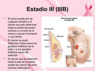 Estadio III (IIIB)
• El tumor puede ser de
cualquier tamaño y el
cáncer se pudo diseminar
hasta la pared del pecho
torácica o a la piel de la
mama y causar hinchazón
o una úlcera.
• El cáncer se pudo
diseminar hasta nueve los
ganglios linfáticos de la
axila o a los ganglios
linfáticos cerca del
esternón.
• El cáncer que se diseminó
hasta la piel de la mama
puede ser cáncer de seno
(mama) inflamatorio.
 