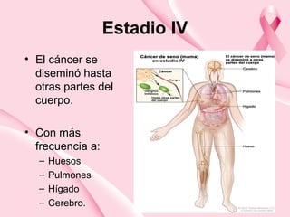 Estadio IV
• El cáncer se
diseminó hasta
otras partes del
cuerpo.
• Con más
frecuencia a:
– Huesos
– Pulmones
– Hígado
– Cerebro.
 
