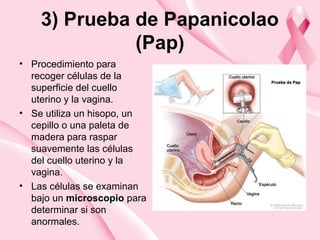 3) Prueba de Papanicolao
(Pap)
• Procedimiento para
recoger células de la
superficie del cuello
uterino y la vagina.
• Se utiliza un hisopo, un
cepillo o una paleta de
madera para raspar
suavemente las células
del cuello uterino y la
vagina.
• Las células se examinan
bajo un microscopio para
determinar si son
anormales.
 
