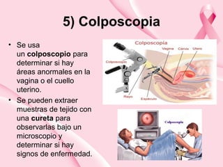 5) Colposcopia
• Se usa
un colposcopio para
determinar si hay
áreas anormales en la
vagina o el cuello
uterino.
• Se pueden extraer
muestras de tejido con
una cureta para
observarlas bajo un
microscopio y
determinar si hay
signos de enfermedad.
 