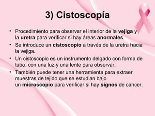 3) Cistoscopía
• Procedimiento para observar el interior de la vejiga y
la uretra para verificar si hay áreas anormales.
• Se introduce un cistoscopio a través de la uretra hacia
la vejiga.
• Un cistoscopio es un instrumento delgado con forma de
tubo, con una luz y una lente para observar.
• También puede tener una herramienta para extraer
muestras de tejido que se estudian bajo
un microscopio para verificar si hay signos de cáncer.
 