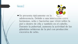 Causas.!
Se presenta típicamente en la
adolescencia. Debido a una interacción entre
hormonas, sebo y bacterias que viven sobre la
piel o dentro de ella y también en el cabello.
Durante la pubertad, aumenta la actividad de las
glándulas sebáceas de la piel con producción
excesiva de sebo.
 