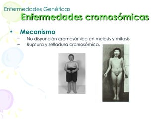 Enfermedades Genéticas   Enfermedades cromosómicas  Mecanismo No disyunción cromosómica en meiosis y mitosis Ruptura y selladura cromosómica.   