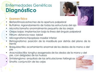 Enfermedades Genéticas Diagnóstico Examen físico Blefarofimosis:estrechez de la apertura palpebral Buftalmo: Agrandamiento de todas las estructuras del ojo Microtia:tamaño anormalmente pequeño de las orejas Orejas bajas: Implantacion bajo la línea del ángulo palpebral Filtrum: distancia naso -labial Micrognatismo:hipoplasia maxilar inferior Retrognatismo: posición de la madibula por detrás del plano de la frente Braquidactilia: acortamiento anormal de los dedos de la mano o del pie Aracnodactilia: longitus exagerada de los dedos de la mano y del pie, con delgadez de los huesos Sinfalangismo: anquilosis de las articulaciones falángicas Sinofris: conjunción de las cejas 