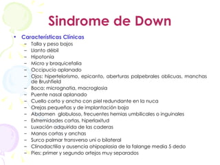 Sindrome de Down Características Clínicas Talla y peso bajos Llanto débil Hipotonía Micro y braquicefalia Occipucio aplanado Ojos: hipertelorismo, epicanto, aberturas palpebrales oblicuas, manchas de Brushfield Boca: micrognatia, macroglosia Puente nasal aplanado Cuello corto y ancho con piel redundante en la nuca Orejas pequeñas y de implantación baja Abdomen  globuloso, frecuentes hernias umbilicales o inguinales Extremidades cortas, hiperlaxitud Luxación adquirida de las caderas Manos cortas y anchas Surco palmar transverso uni o bilateral Clinodactilia y ausencia ohipoplasia de la falange media 5 dedo Pies: primer y segundo ortejos muy separados Información acerca del Sd de down Riesgo de rrecurrencia Trisomía libre: 1% dependiente de la edad materna Translocación: madre 10-16%; padre 2-5% 