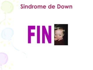 Sindrome de Down FIN 