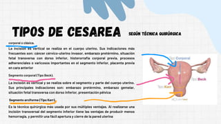 Diapositiva para una intervención de cesaria | PDF