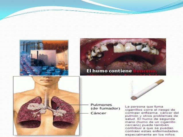 Diapositiva del benceno