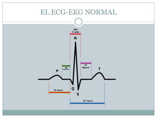 EL ECG-EKG NORMAL