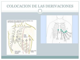 COLOCACION DE LAS DERIVACIONES