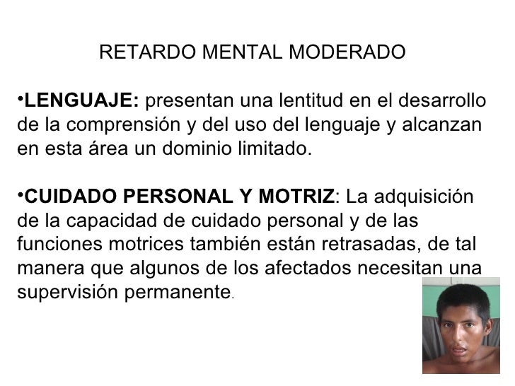 RETARDO Y RETRASO MENTAL by Jeniffer Morales on Prezi