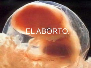 EL ABORTO . 