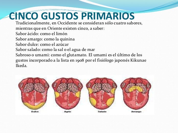 Diapositivas