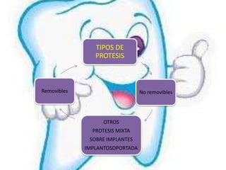 TIPOS DE
                PROTESIS



Removibles                       No removibles




                   OTROS
               PROTESIS MIXTA
              SOBRE IMPLANTES
             IMPLANTOSOPORTADA
 