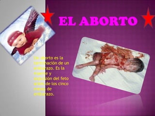 Un aborto es la
terminación de un
embarazo. Es la
muerte y
expulsión del feto
antes de los cinco
meses de
embarazo.
 