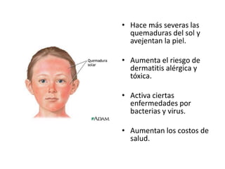 • Hace más severas las
quemaduras del sol y
avejentan la piel.
• Aumenta el riesgo de
dermatitis alérgica y
tóxica.
• Activa ciertas
enfermedades por
bacterias y virus.
• Aumentan los costos de
salud.

 