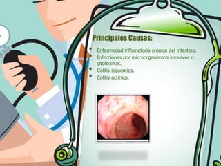 Principales Causas:

•
•
•
•

Enfermedad inflamatoria crónica del intestino.
Infecciones por microorganismos invasivos o
citotoxinas.
Colitis isquémica.
Colitis actínica.

 