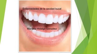 Enfermedades de la cavidad bucal
Mariana Hidalgo González
 