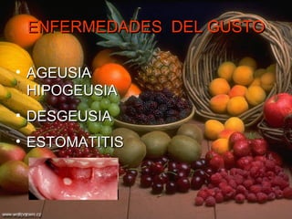ENFERMEDADES  DEL GUSTO AGEUSIA  HIPOGEUSIA DESGEUSIA ESTOMATITIS 